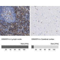 GIMAP4 Antibody, Novus Biologicals 25 &mu;L; Unlabeled:Antibodies, Polyclonal