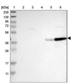 GIMAP4 Antibody, Novus Biologicals 25 &mu;L; Unlabeled:Antibodies, Polyclonal