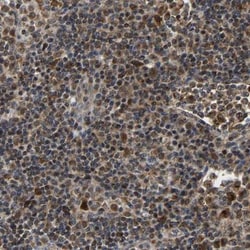 GIMAP7 Antibody, Novus Biologicals 25 &mu;L; Unlabeled:Antibodies, Polyclonal