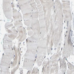 GIMAP7 Antibody, Novus Biologicals 25 &mu;L; Unlabeled:Antibodies, Polyclonal