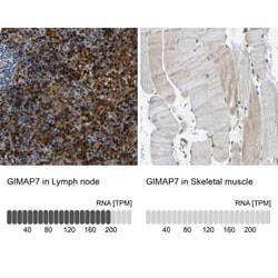 GIMAP7 Antibody, Novus Biologicals 25 &mu;L; Unlabeled:Antibodies, Polyclonal
