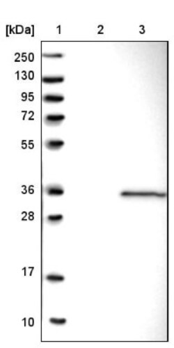 GINS4 Antibody, Novus Biologicals 0.1 mL | Buy Online | Novus Biologicals | Fisher Scientific