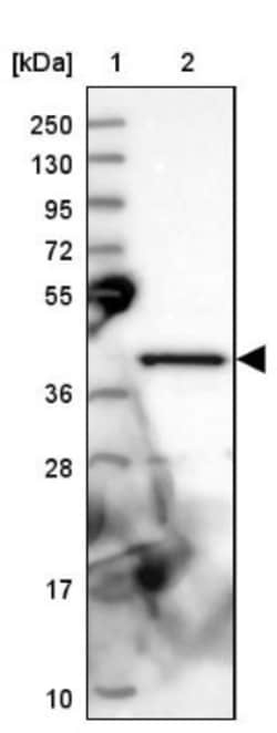 GIPC1 Antibody, Novus Biologicals 0.1mL; Unlabeled:Antibodies, Polyclonal