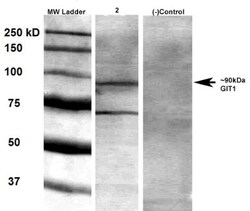 GIT1 Antibody (S39B-8), Novus Biologicals:Antibodies:Primary Antibodies