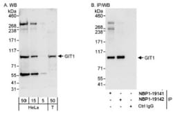 GIT1 Antibody, Novus Biologicals 0.1 mL | Buy Online | Novus Biologicals | Fisher Scientific
