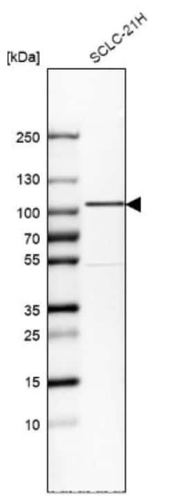 GIT1 Antibody, Novus Biologicals 0.1mL; Unlabeled:Antibodies, Polyclonal
