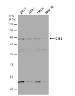 GIT2 Antibody, Novus Biologicals 0.1mL; Unlabeled:Antibodies, Polyclonal