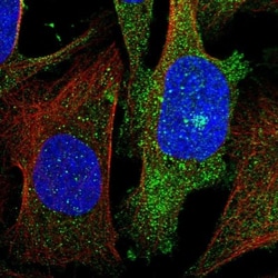 GKAP1 Antibody, Novus Biologicals 0.1mL; Unlabeled:Antibodies, Polyclonal