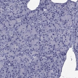GKAP1 Antibody, Novus Biologicals 0.1mL; Unlabeled:Antibodies, Polyclonal