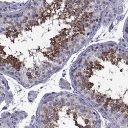 GKAP1 Antibody, Novus Biologicals 0.1mL; Unlabeled:Antibodies, Polyclonal