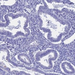 GLB1L Antibody, Novus Biologicals:Antibodies:Primary Antibodies
