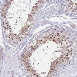 GLB1L Antibody, Novus Biologicals:Antibodies:Primary Antibodies