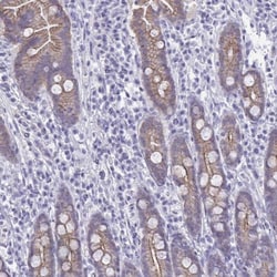 GLB1L2 Antibody, Novus Biologicals 0.1mL; Unlabeled:Antibodies, Polyclonal