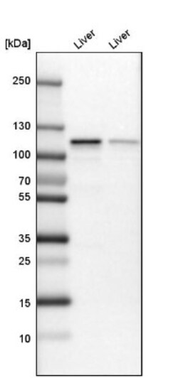 GLDC Antibody, Novus Biologicals:Antibodies:Primary Antibodies