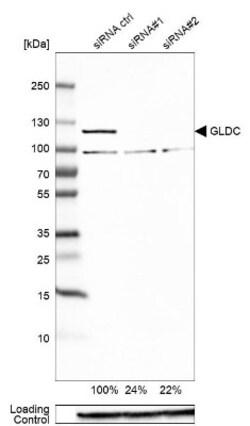 GLDC Antibody, Novus Biologicals:Antibodies:Primary Antibodies