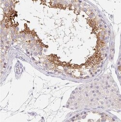 GLIPR1L1 Antibody, Novus Biologicals 25 &mu;L; Unlabeled:Antibodies, Polyclonal
