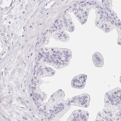 GLIPR1L1 Antibody, Novus Biologicals 25 &mu;L; Unlabeled:Antibodies, Polyclonal