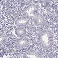 GLIPR1L2 Antibody, Novus Biologicals:Antibodies:Primary Antibodies