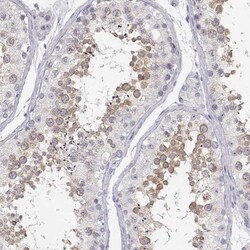 GLIPR1L2 Antibody, Novus Biologicals:Antibodies:Primary Antibodies