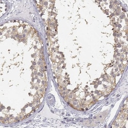 GLIPR1L2 Antibody, Novus Biologicals 0.1mL; Unlabeled:Antibodies, Polyclonal