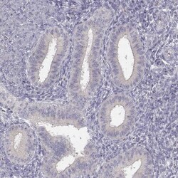 GLIPR1L2 Antibody, Novus Biologicals 0.1mL; Unlabeled:Antibodies, Polyclonal