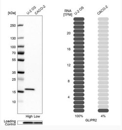 GLIPR2 Antibody, Novus Biologicals 0.1mL; Unlabeled:Antibodies, Polyclonal