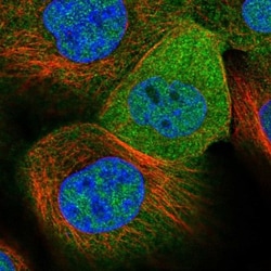 GLOD4 Antibody, Novus Biologicals 0.1mL; Unlabeled:Antibodies, Polyclonal