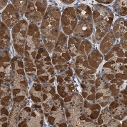 GLOD4 Antibody, Novus Biologicals 0.1mL; Unlabeled:Antibodies, Polyclonal