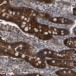 GLOD4 Antibody, Novus Biologicals 0.1mL; Unlabeled:Antibodies, Polyclonal