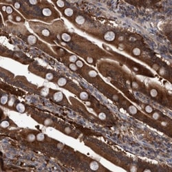 GLOD4 Antibody, Novus Biologicals 25 &mu;L | Buy Online | Novus Biologicals | Fisher Scientific