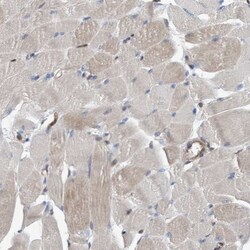 GLOD4 Antibody, Novus Biologicals 25 &mu;L | Buy Online | Novus Biologicals | Fisher Scientific