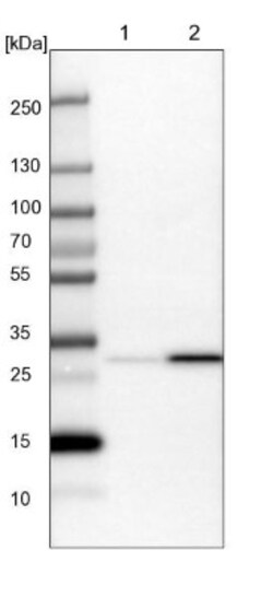 GLOD4 Antibody, Novus Biologicals 0.1mL; Unlabeled:Antibodies, Polyclonal