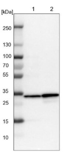 GLOD4 Antibody, Novus Biologicals 25 &mu;L | Buy Online | Novus Biologicals | Fisher Scientific