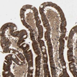 GLOD5 Antibody, Novus Biologicals:Antibodies:Primary Antibodies