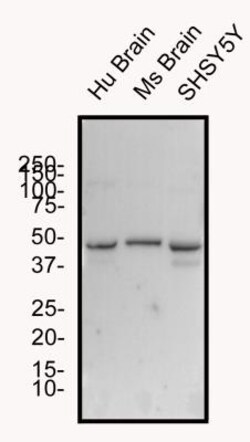 GLP-1R Antibody - BSA Free, Novus Biologicals 0.025mL; Unlabeled:Antibodies,