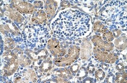 GLS2 Antibody, Novus Biologicals 100 ul; Unconjugated:Antibodies, Polyclonal