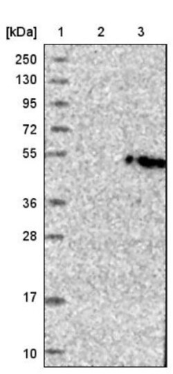 GLT8D2 Antibody, Novus Biologicals 25 &mu;L; Unlabeled:Antibodies, Polyclonal