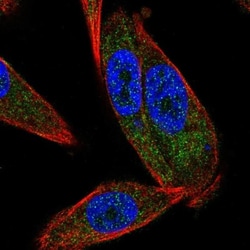 GLTP Antibody, Novus Biologicals 0.1mL; Unlabeled:Antibodies, Polyclonal
