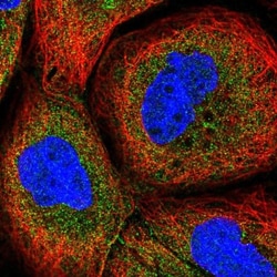 GLTPD1 Antibody, Novus Biologicals 0.1mL; Unlabeled:Antibodies, Polyclonal