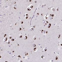 GLTPD2 Antibody, Novus Biologicals:Antibodies:Primary Antibodies