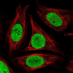 GLTSCR1 Antibody, Novus Biologicals 0.1mL; Unlabeled:Antibodies, Polyclonal