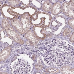 GLUT9 Antibody, Novus Biologicals 25 &mu;L; Unlabeled:Antibodies, Polyclonal