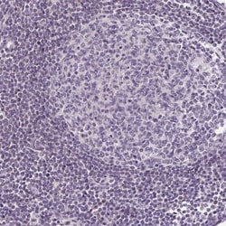 GLUT9 Antibody, Novus Biologicals 25 &mu;L; Unlabeled:Antibodies, Polyclonal