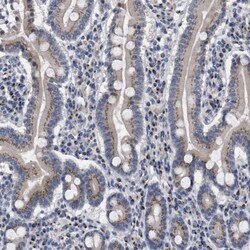 GM130/GOLGA2 Antibody, Novus Biologicals 25 &mu;L | Buy Online | Novus Biologicals | Fisher Scientific