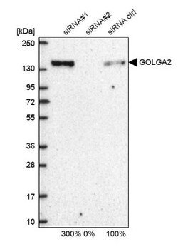 GM130/GOLGA2 Antibody, Novus Biologicals 0.1mL; Unlabeled:Antibodies, Polyclonal