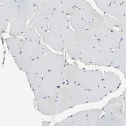 GM2A Antibody, Novus Biologicals 25 &mu;L; Unlabeled:Antibodies, Polyclonal