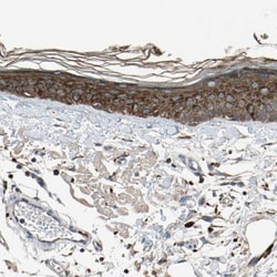 GM2A Antibody, Novus Biologicals 25 &mu;L; Unlabeled:Antibodies, Polyclonal