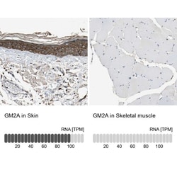 GM2A Antibody, Novus Biologicals 25 &mu;L; Unlabeled:Antibodies, Polyclonal