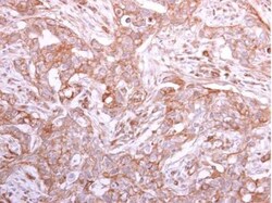 GMDS Antibody, Novus Biologicals 0.1mg; Unlabeled:Antibodies, Polyclonal