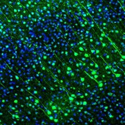 GMF-beta Antibody, Novus Biologicals:Antibodies:Primary Antibodies